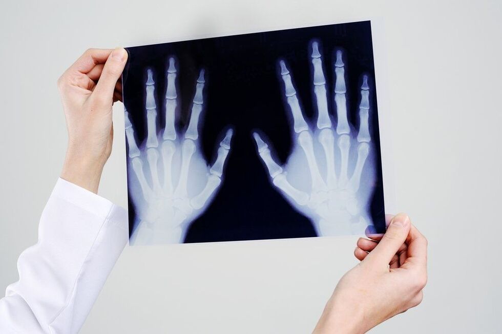 диагностика на ставите на ръцете